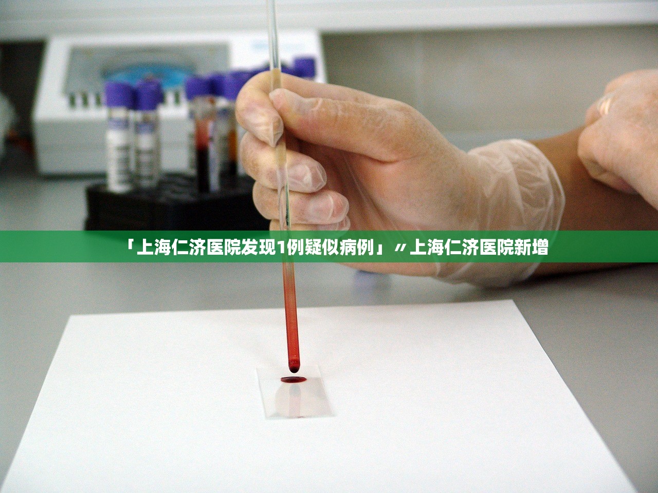 「上海仁济医院发现1例疑似病例」〃上海仁济医院新增