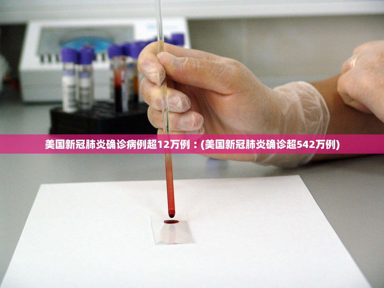 美国新冠肺炎确诊病例超12万例︰(美国新冠肺炎确诊超542万例)
